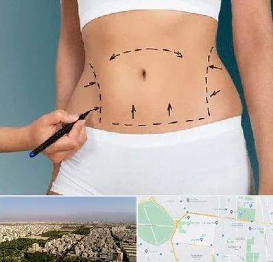 دکتر طب سنتی برای لاغری در نازی آباد 