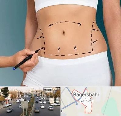 دکتر طب سنتی برای لاغری در باقرشهر