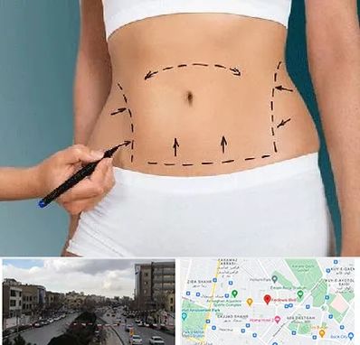 دکتر طب سنتی برای لاغری در بلوار فردوسی مشهد 