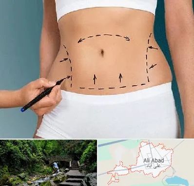 دکتر طب سنتی برای لاغری در علی آباد کتول