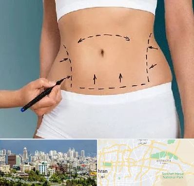 دکتر طب سنتی برای لاغری در شرق تهران 