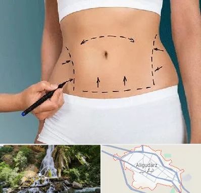 دکتر طب سنتی برای لاغری در الیگودرز