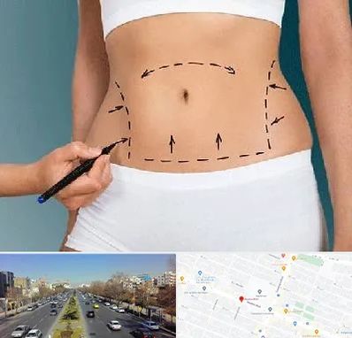 دکتر طب سنتی برای لاغری در بلوار معلم مشهد 