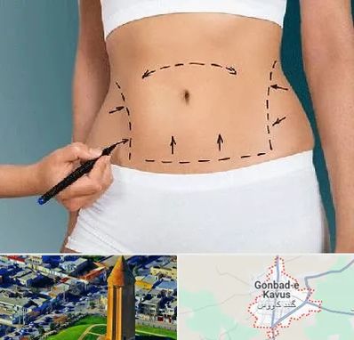 دکتر طب سنتی برای لاغری در گنبد کاووس