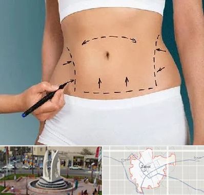 دکتر طب سنتی برای لاغری در زابل