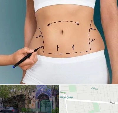 دکتر طب سنتی برای لاغری در بریانک