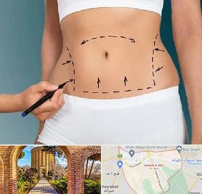 دکتر طب سنتی برای لاغری در شهر ری