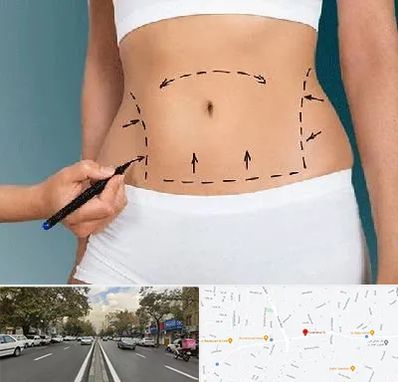 دکتر طب سنتی برای لاغری در دولت 