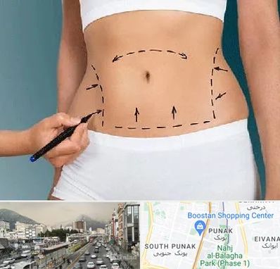 دکتر طب سنتی برای لاغری در پونک 