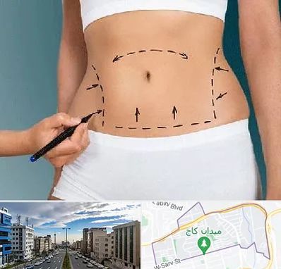 دکتر طب سنتی برای لاغری در سعادت آباد 