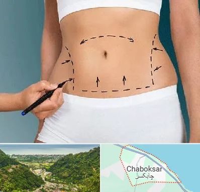 دکتر طب سنتی برای لاغری در چابکسر