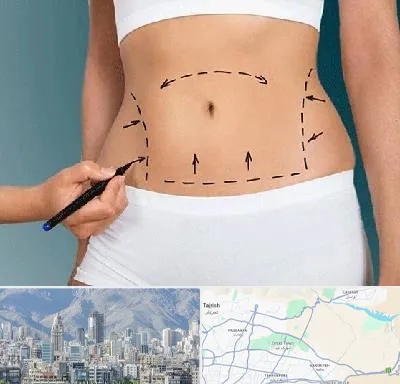 دکتر طب سنتی برای لاغری در شمال شرق تهران