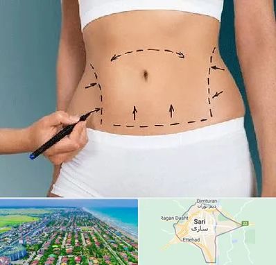 دکتر طب سنتی برای لاغری در ساری