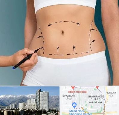 دکتر طب سنتی برای لاغری در شهرک غرب 