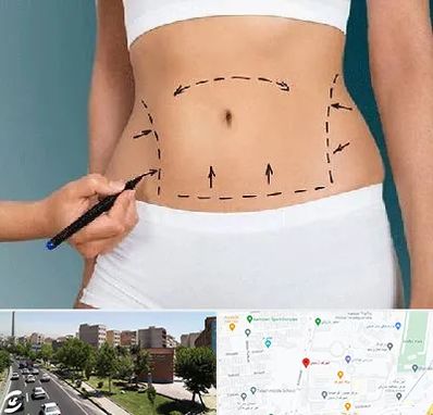 دکتر طب سنتی برای لاغری در شهرک آزمایش 