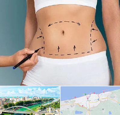 دکتر طب سنتی برای لاغری در بابلسر