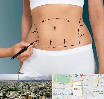 دکتر طب سنتی برای لاغری در گیشا 