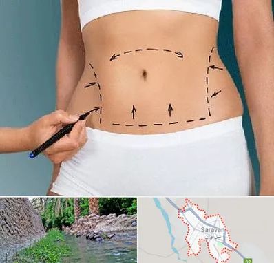 دکتر طب سنتی برای لاغری در سراوان