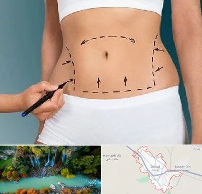 دکتر طب سنتی برای لاغری در دورود