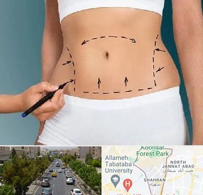 دکتر طب سنتی برای لاغری در شهران 