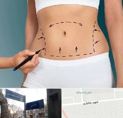 دکتر طب سنتی برای لاغری در سی متری جی