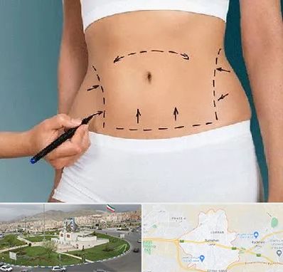 دکتر طب سنتی برای لاغری در بومهن