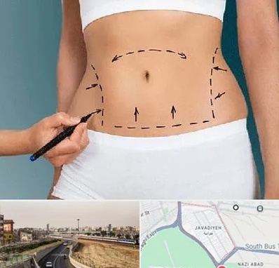 دکتر طب سنتی برای لاغری در جوادیه