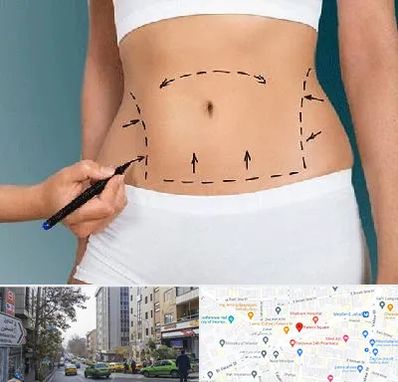 دکتر طب سنتی برای لاغری در فاطمی 