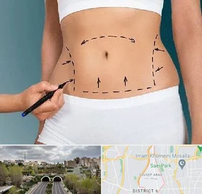 دکتر طب سنتی برای لاغری در یوسف آباد 