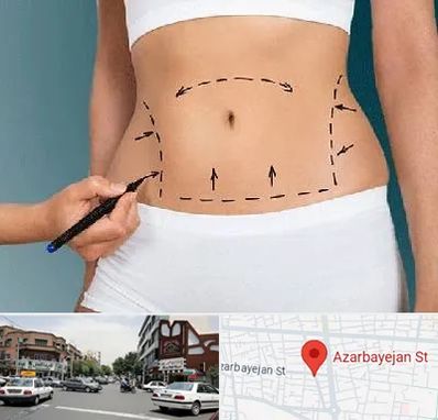 دکتر طب سنتی برای لاغری در خیابان آذربایجان