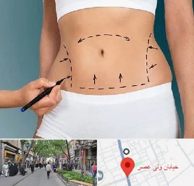 دکتر طب سنتی برای لاغری در ولیعصر شهریار