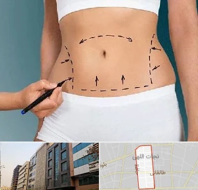 دکتر طب سنتی برای لاغری در نجات اللهی