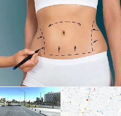 دکتر طب سنتی برای لاغری در بلوار کلاهدوز مشهد 