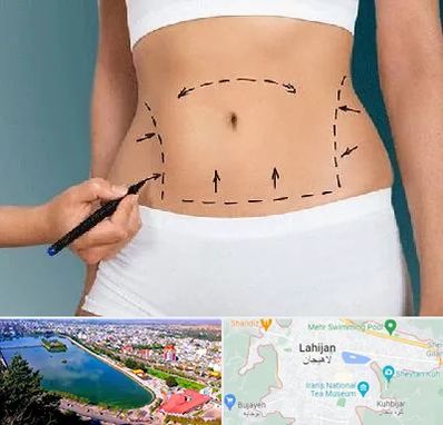 دکتر طب سنتی برای لاغری در لاهیجان