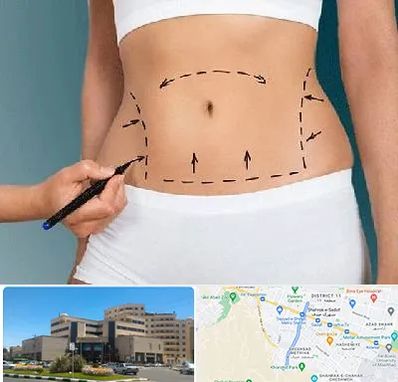 دکتر طب سنتی برای لاغری در صیاد شیرازی مشهد 