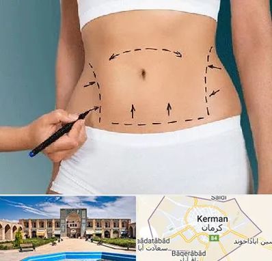 دکتر طب سنتی برای لاغری در کرمان