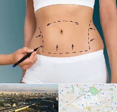 دکتر طب سنتی برای لاغری در منطقه 19 تهران 