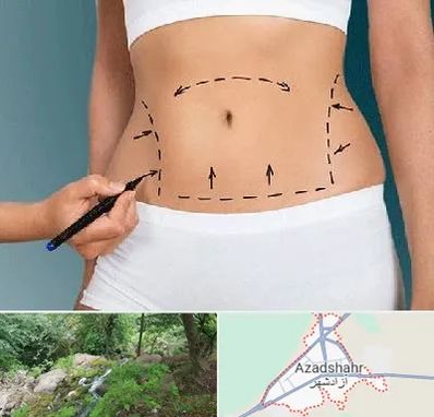 دکتر طب سنتی برای لاغری در آزادشهر