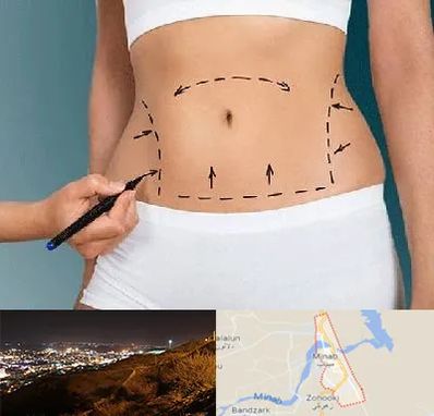 دکتر طب سنتی برای لاغری در میناب
