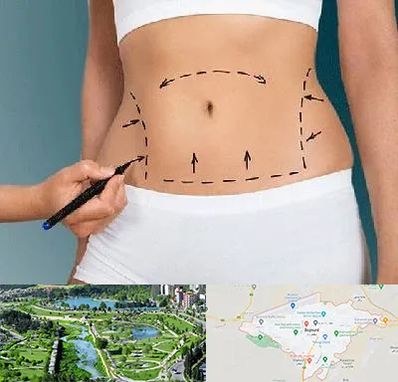 دکتر طب سنتی برای لاغری در بجنورد