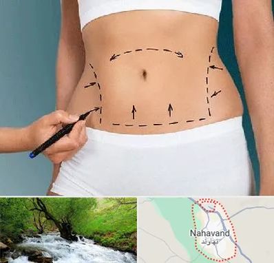 دکتر طب سنتی برای لاغری در نهاوند