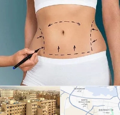دکتر طب سنتی برای لاغری در جنوب غرب تهران