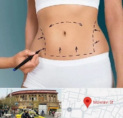 دکتر طب سنتی برای لاغری در مولوی