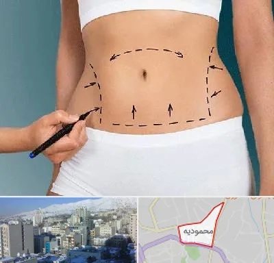 دکتر طب سنتی برای لاغری در محمودیه