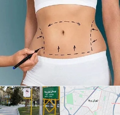 دکتر طب سنتی برای لاغری در تهران ویلا