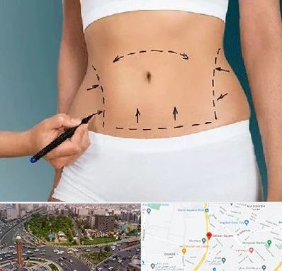 دکتر طب سنتی برای لاغری در سبلان 