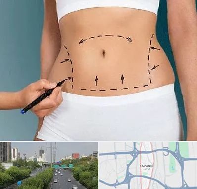 دکتر طب سنتی برای لاغری در توانیر