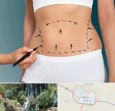 دکتر طب سنتی برای لاغری در شیروان