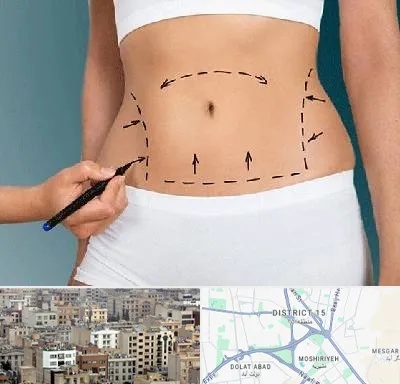 دکتر طب سنتی برای لاغری در جنوب شرق تهران