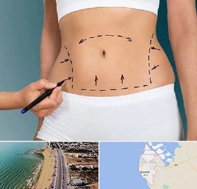 دکتر طب سنتی برای لاغری در بوشهر